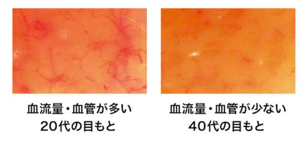 目もとの毛細血管の年代別変化